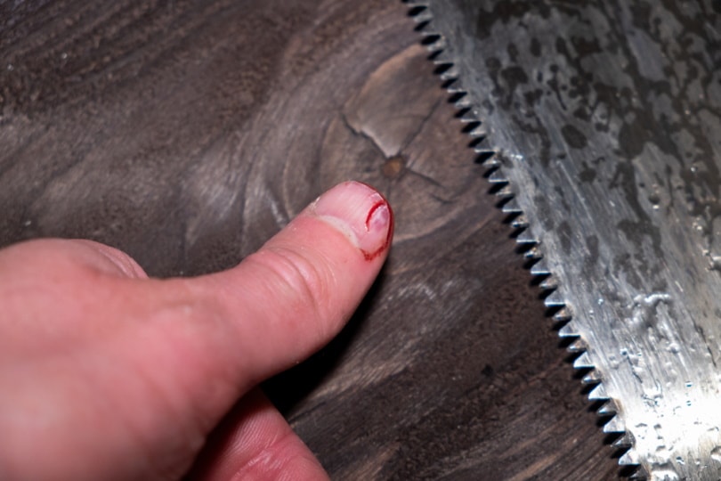 finger injured by saw