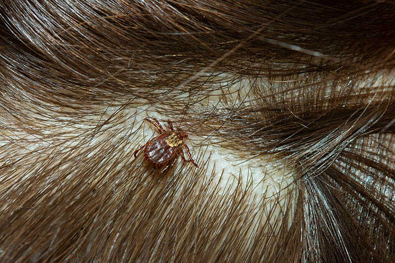 close up of an american dog tick