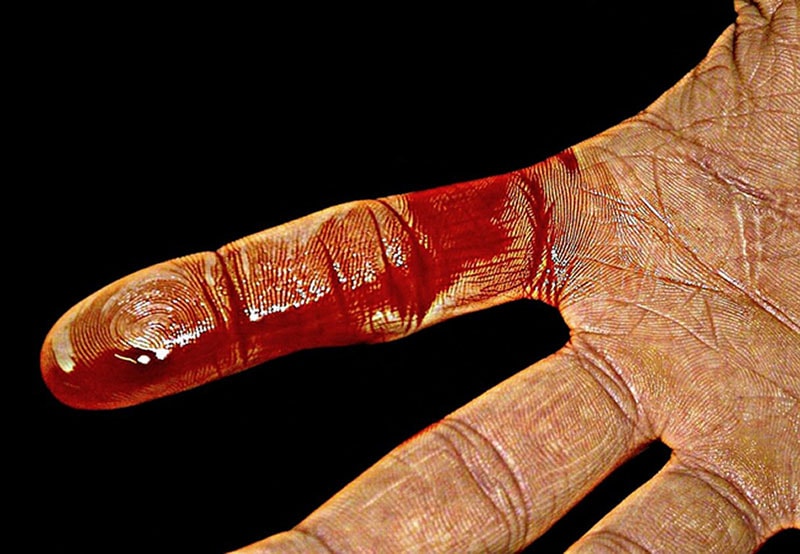 Bloody finger