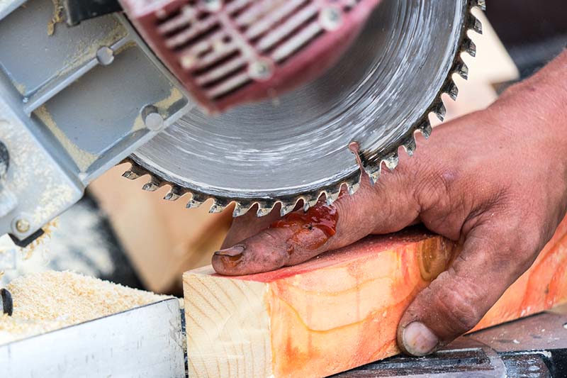 Injury when working with a saw