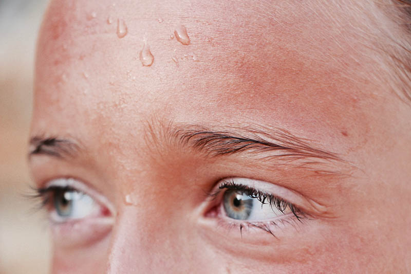 sweat in forehead
