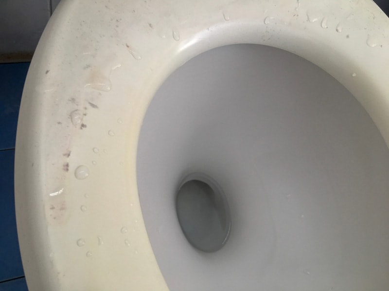toilet bowl with fungus and bacteria