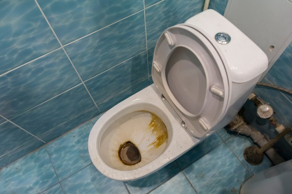 dirty toilet bowl